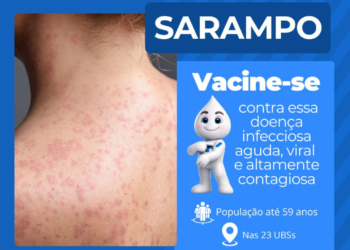 Mobilização contra o sarampo é antecipada em Mauá